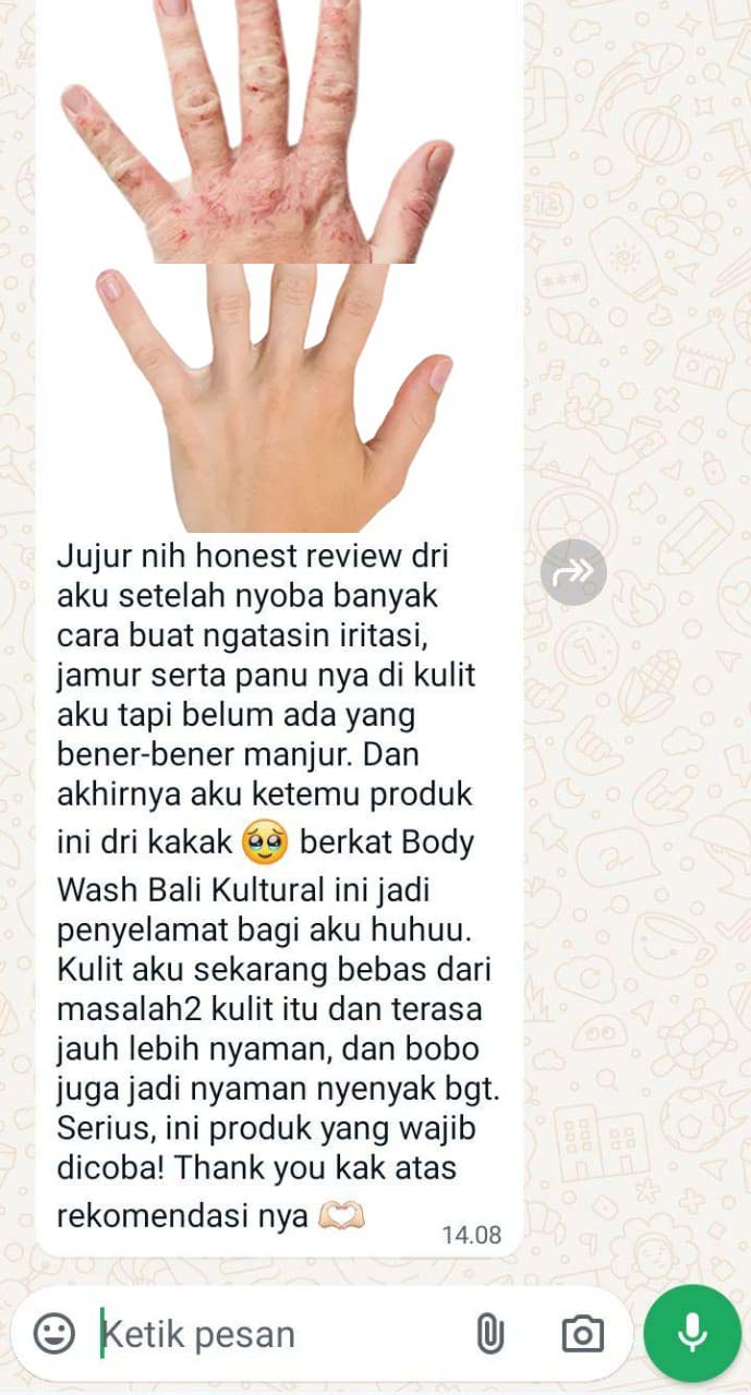 testi-bk2-1.jpg